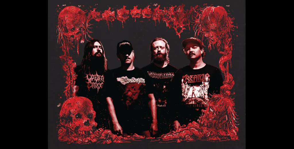 caesarean band photo