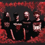 caesarean band photo