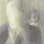 intraether band photo