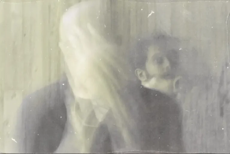 intraether band photo